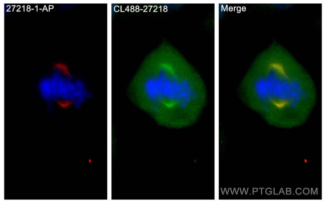 KIF2A Antibody in Immunocytochemistry (ICC/IF)