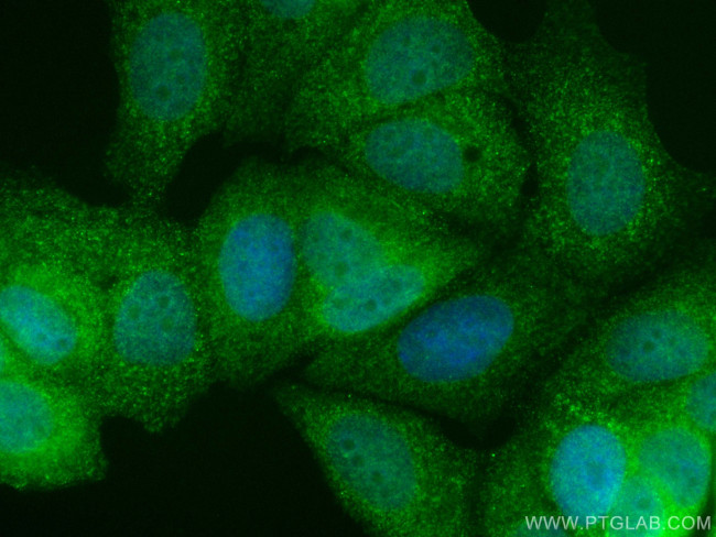 DVL1 Antibody in Immunocytochemistry (ICC/IF)