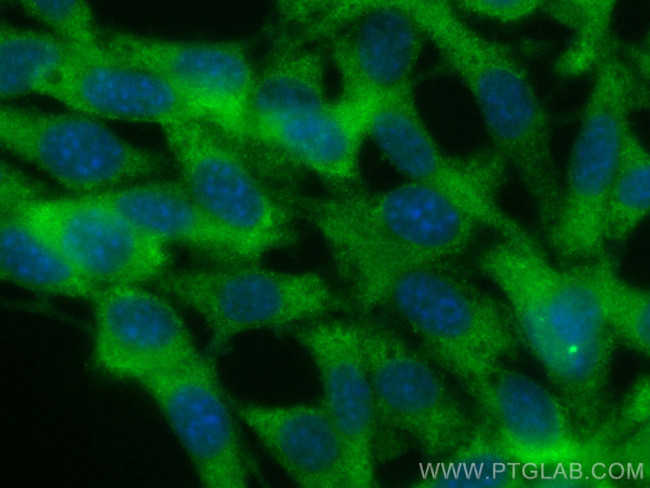 RAB5B Antibody in Immunocytochemistry (ICC/IF)
