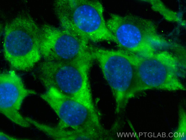 NPPA Antibody in Immunocytochemistry (ICC/IF)
