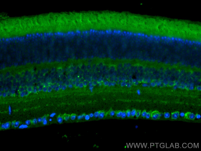 CACNA2D1 Antibody in Immunohistochemistry (PFA fixed) (IHC (PFA))