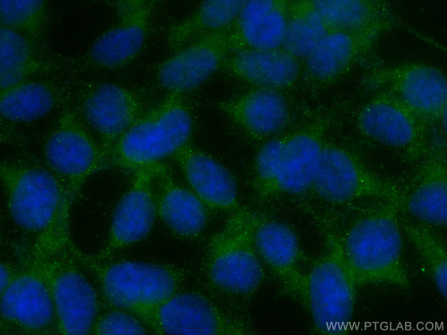 ELA2 Antibody in Immunocytochemistry (ICC/IF)
