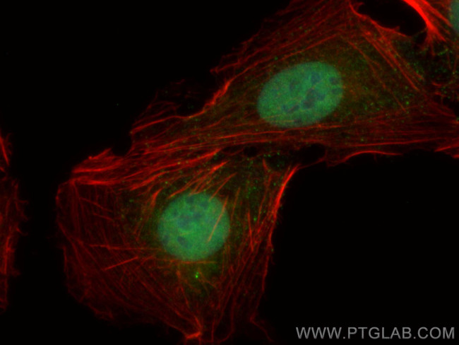 FTSJD2 Antibody in Immunocytochemistry (ICC/IF)
