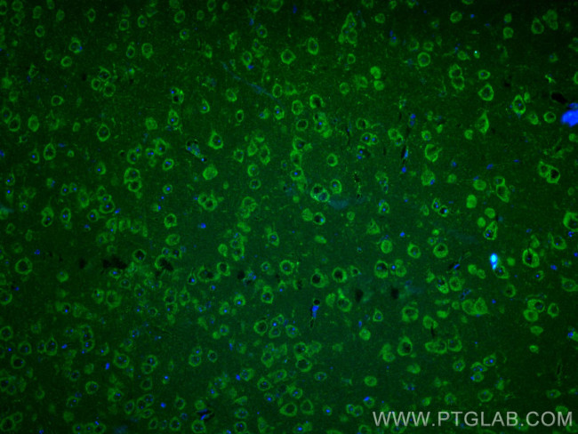 ANK3 Antibody in Immunohistochemistry (PFA fixed) (IHC (PFA))
