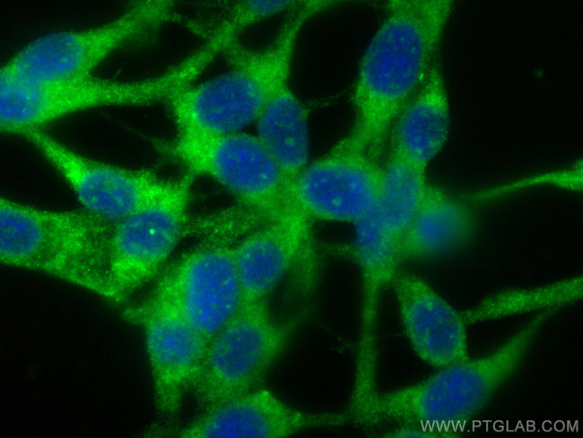 Titin Antibody in Immunocytochemistry (ICC/IF)