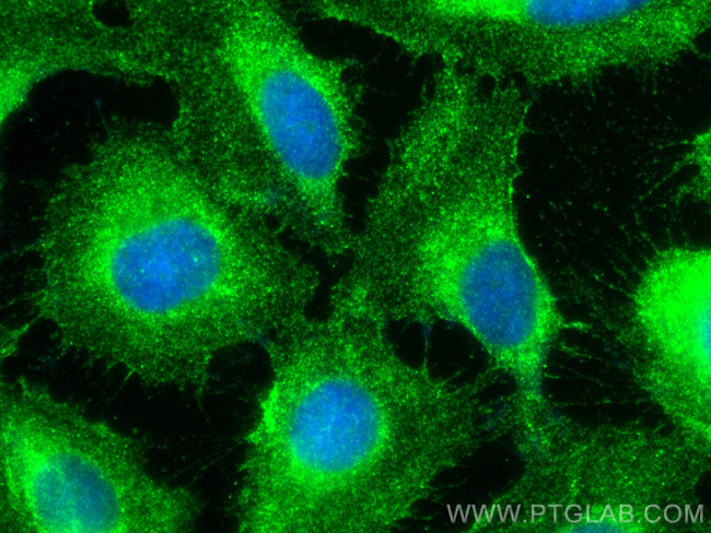 NKCC1, SLC12A2 Antibody in Immunocytochemistry (ICC/IF)