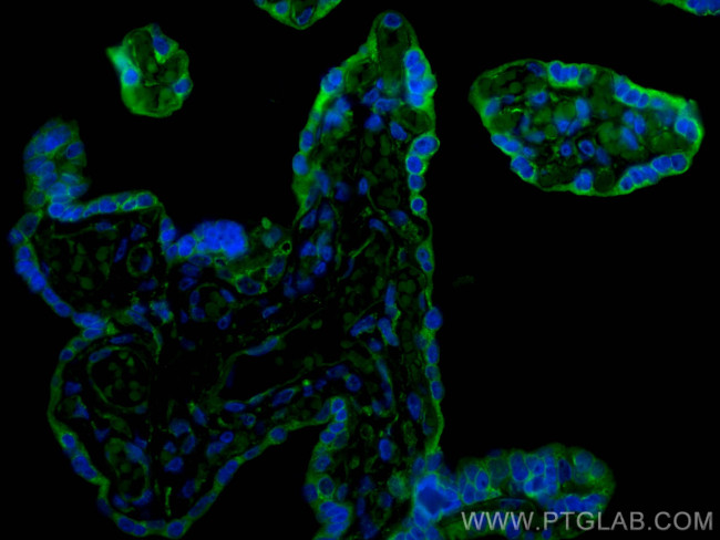 PD-L1/CD274 Antibody in Immunohistochemistry (PFA fixed) (IHC (PFA))