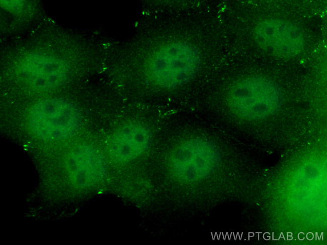LIMD1 Antibody in Immunocytochemistry (ICC/IF)