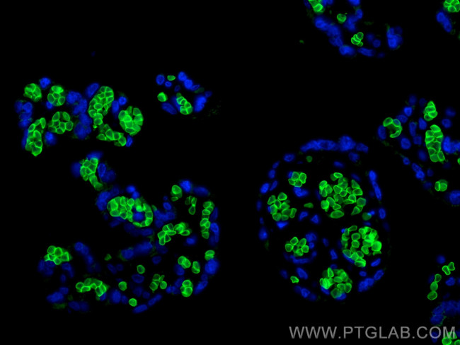 Band 3/AE 1 Antibody in Immunohistochemistry (PFA fixed) (IHC (PFA))