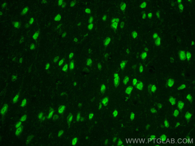 NET1 Antibody in Immunohistochemistry (PFA fixed) (IHC (PFA))