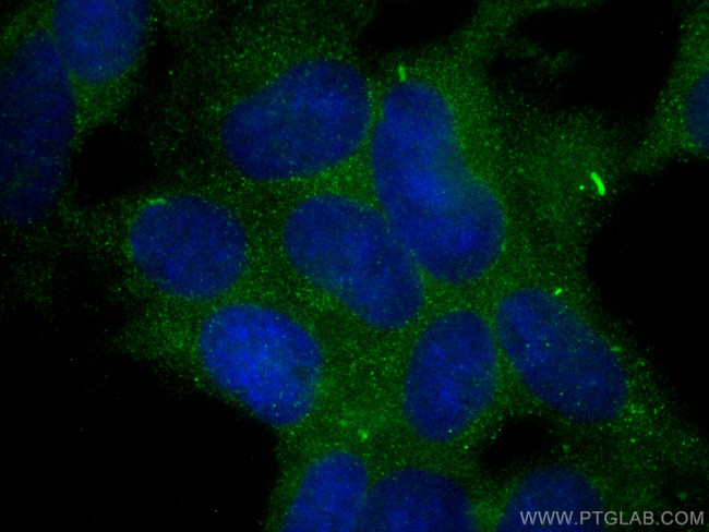Collagen Type II Antibody in Immunocytochemistry (ICC/IF)