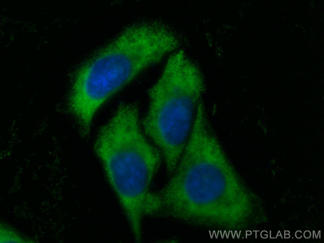 Alpha-2-antiplasmin Antibody in Immunocytochemistry (ICC/IF)