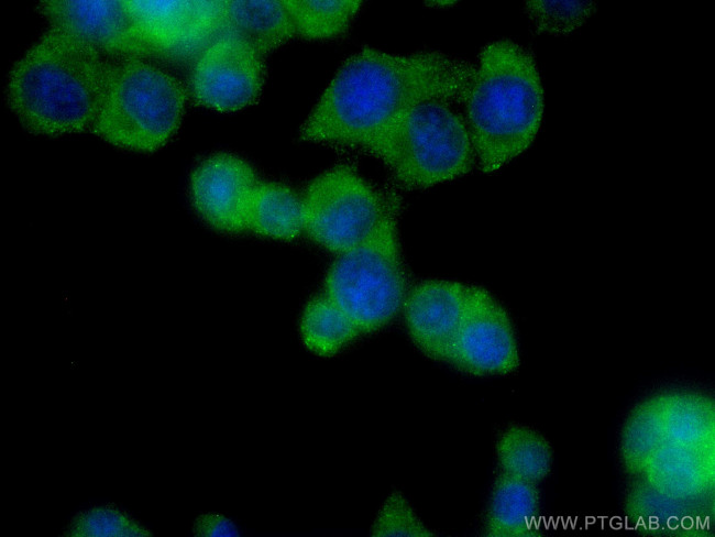 TAC1 Antibody in Immunocytochemistry (ICC/IF)