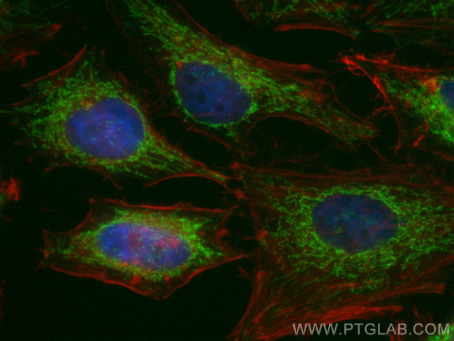 Sam50 Antibody in Immunocytochemistry (ICC/IF)