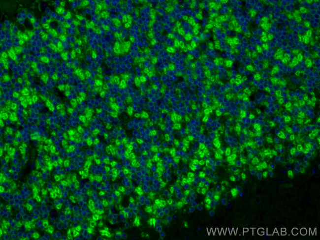KCC2/SLC12A5 Antibody in Immunohistochemistry (PFA fixed) (IHC (PFA))