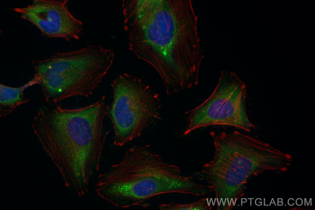 WIPI2 Antibody in Immunocytochemistry (ICC/IF)