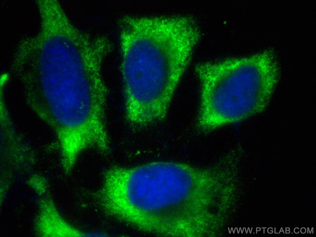 ULK1 Antibody in Immunocytochemistry (ICC/IF)