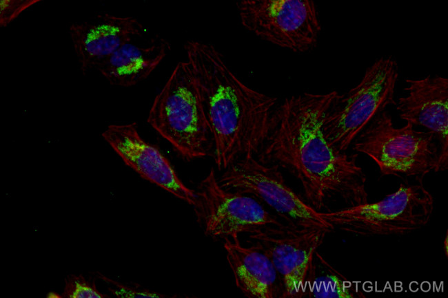 TRMT10C Antibody in Immunocytochemistry (ICC/IF)
