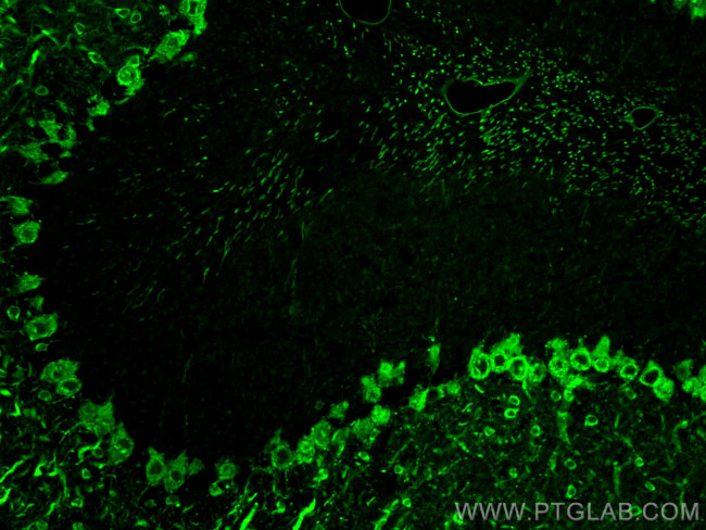 Parvalbumin Antibody in Immunohistochemistry (PFA fixed) (IHC (PFA))