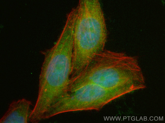 HDAC5 Antibody in Immunocytochemistry (ICC/IF)