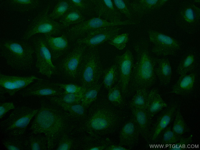 RAD50 Antibody in Immunocytochemistry (ICC/IF)
