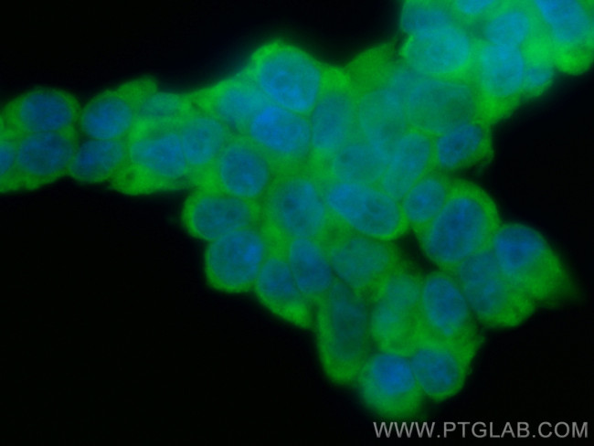 ATG16L1 Antibody in Immunocytochemistry (ICC/IF)