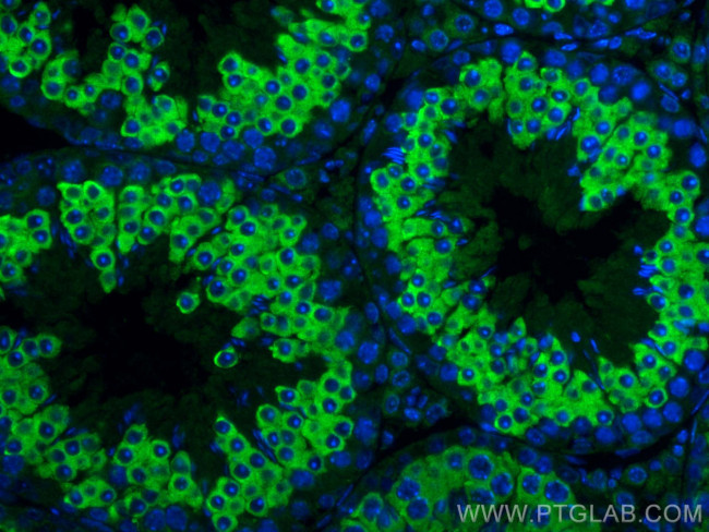 LRRC50 Antibody in Immunohistochemistry (PFA fixed) (IHC (PFA))