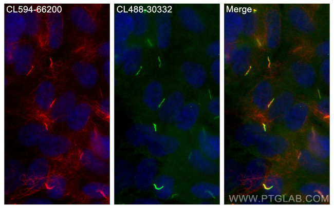 ARL13B Antibody in Immunocytochemistry (ICC/IF)