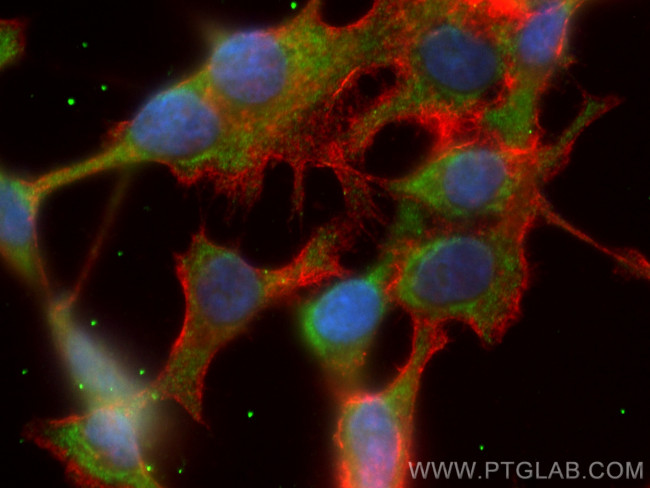 WNT8A Antibody in Immunocytochemistry (ICC/IF)
