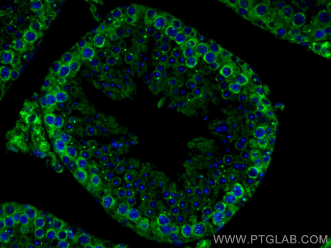 DDX4, VASA Antibody in Immunohistochemistry (PFA fixed) (IHC (PFA))