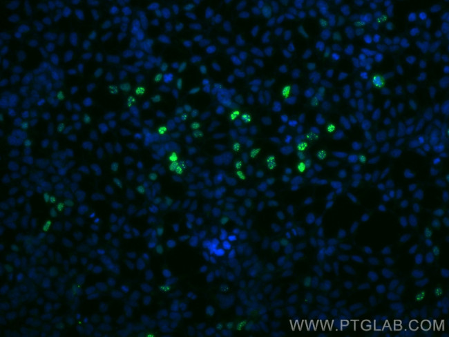 HA tag Antibody in Immunocytochemistry (ICC/IF)