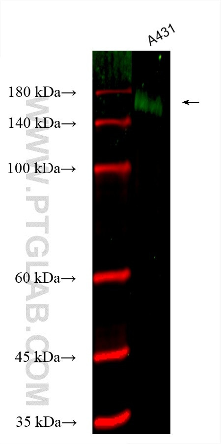EGFR Antibody in Western Blot (WB)