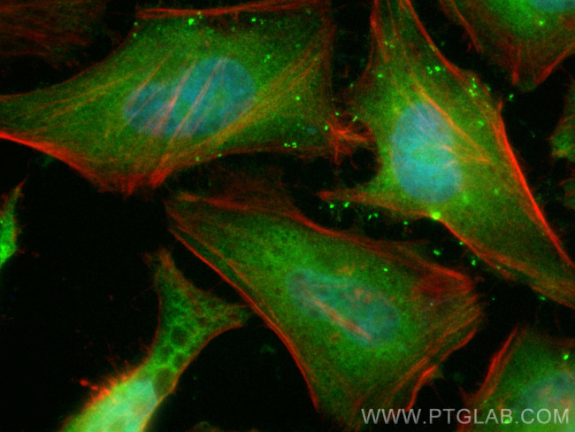 Cyclin B1 Antibody in Immunocytochemistry (ICC/IF)