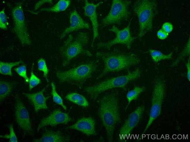 PFKM Antibody in Immunocytochemistry (ICC/IF)