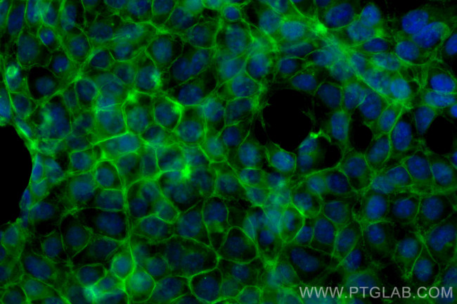 ATP1A1 Antibody in Immunocytochemistry (ICC/IF)