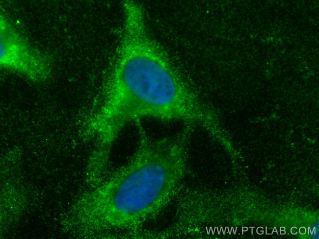 MAT2A Antibody in Immunocytochemistry (ICC/IF)