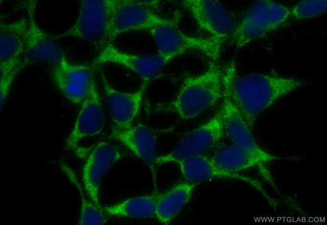 SH2D5 Antibody in Immunocytochemistry (ICC/IF)