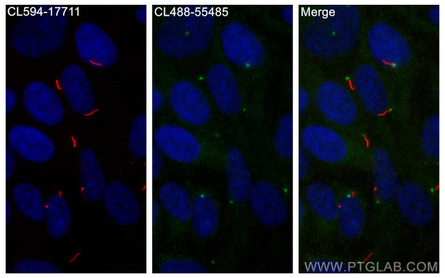 Rootletin Antibody in Immunocytochemistry (ICC/IF)