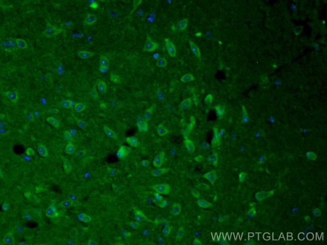 VGLUT1 Antibody in Immunohistochemistry (PFA fixed) (IHC (PFA))