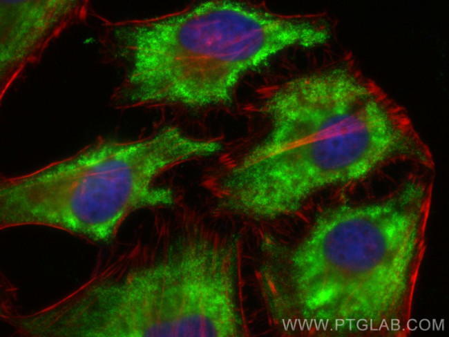 DSE Antibody in Immunocytochemistry (ICC/IF)
