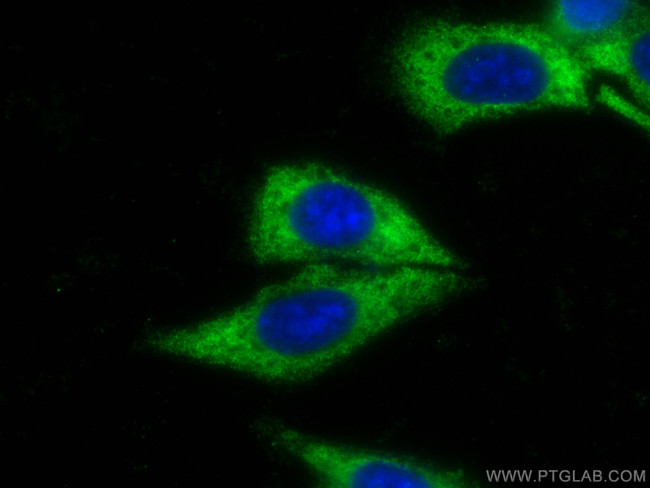 Transgelin 2 Antibody in Immunocytochemistry (ICC/IF)