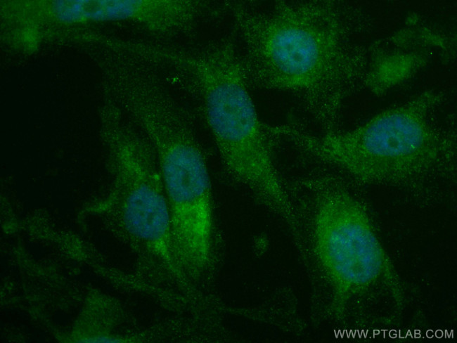 MGP Antibody in Immunocytochemistry (ICC/IF)