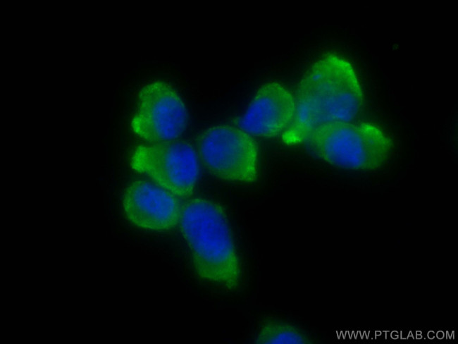 GMF Beta Antibody in Immunocytochemistry (ICC/IF)