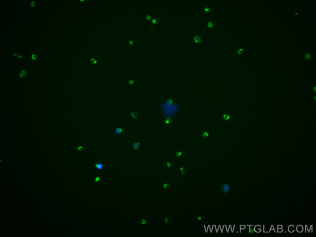 CXCR3B Antibody in Immunocytochemistry (ICC/IF)