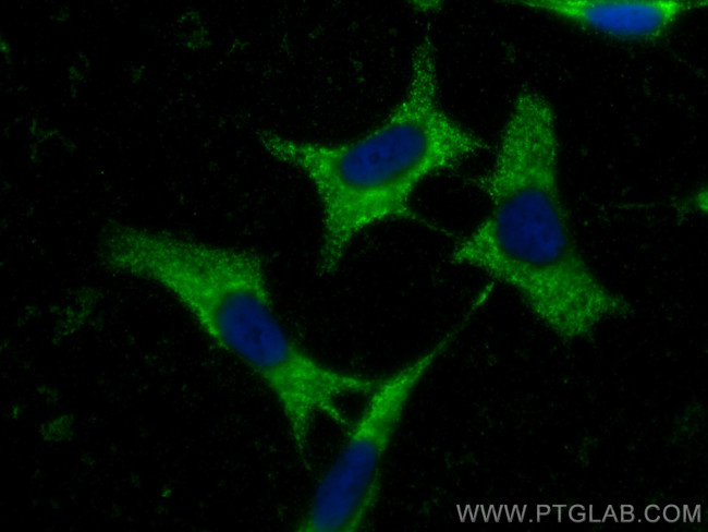 Chromogranin A Antibody in Immunocytochemistry (ICC/IF)
