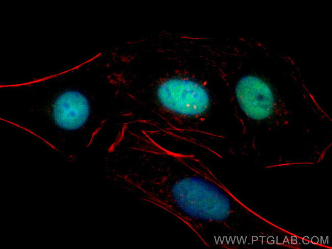 PAX8 Antibody in Immunocytochemistry (ICC/IF)