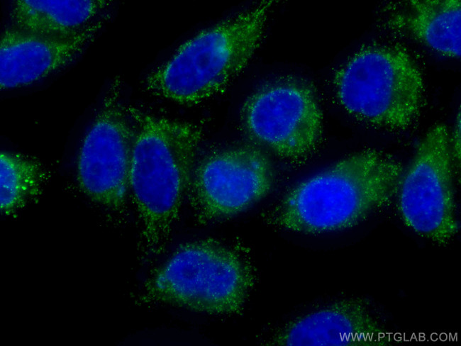 GSTO1 Antibody in Immunocytochemistry (ICC/IF)