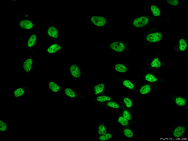 FUS/TLS Antibody in Immunocytochemistry (ICC/IF)