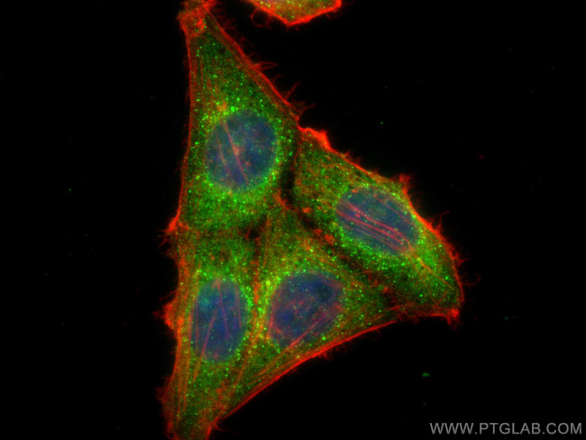 LCK Antibody in Immunocytochemistry (ICC/IF)