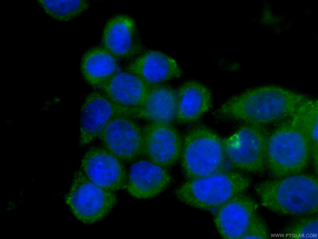 PCMT1 Antibody in Immunocytochemistry (ICC/IF)
